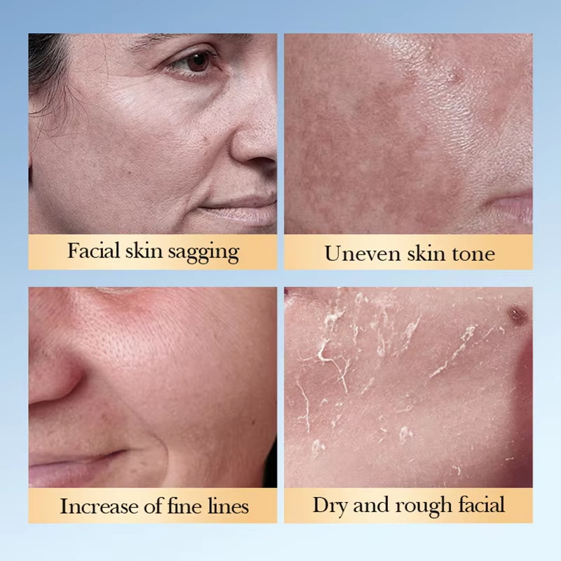 SADOER Tônico Facial com Ácido - Essence Serum Toner avaliação e preço